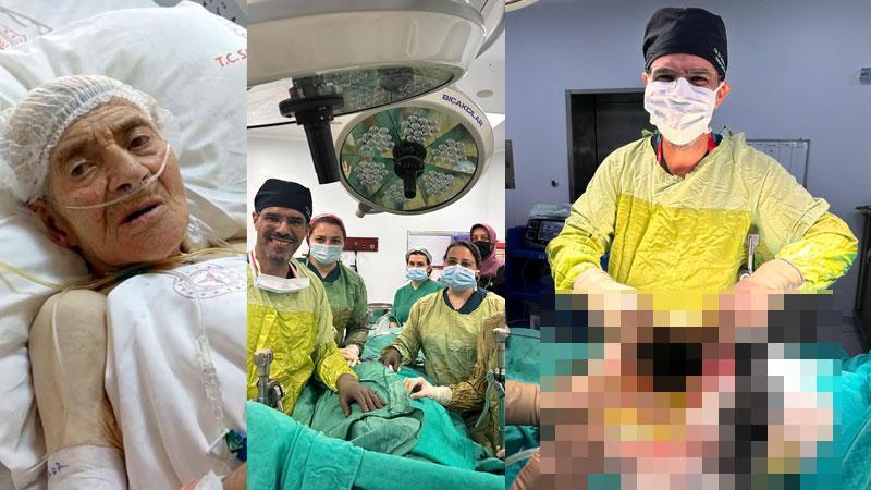 Hastanın karaciğerinden 90 santimetrelik kedi-köpek kisti çıkarıldı