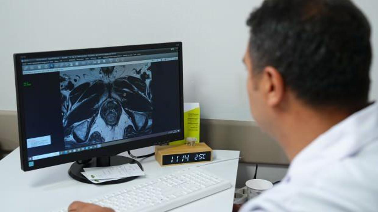 Prostat kanserinde erken ve doğru tanı için “Füzyon biyopsi” dönemi
