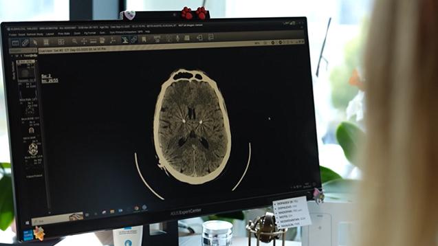 Uzman isim uyardı: Kronik strese dikkat! Beyni küçültüyor, hafızayı zayıflatıyor